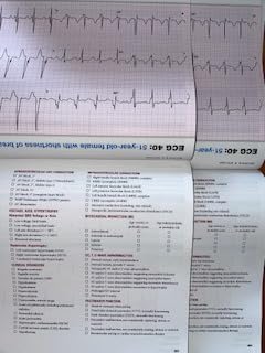 The Complete Guide to ECGs: A Comprehensive Study Guide to Improve ECG Interpretation Skills: A Comprehensive Study Guide to Improve ECG Interpretation Skills 5th Edition 9781284199055 - Image 5