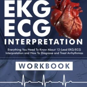 EKG/ECG Interpretation: Everything you Need to Know about the 12 – Lead ECG/EKG Interpretation and How to Diagnose and Treat Arrhythmias: Workbook ISBN-13: 9781958323038