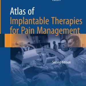 Atlas of Implantable Therapies for Pain Management ISBN-13: 9781493939497