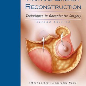 Partial Breast Reconstruction: Techniques in Oncoplastic Surgery ISBN-13: 9781626236912