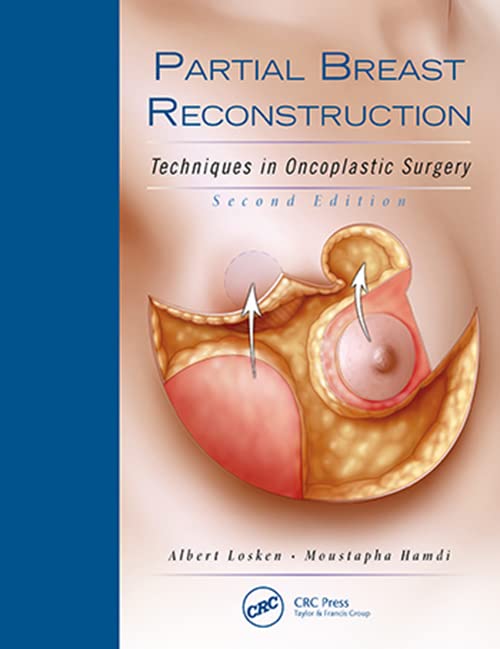 Partial Breast Reconstruction: Techniques in Oncoplastic Surgery ISBN-13: 9781626236912