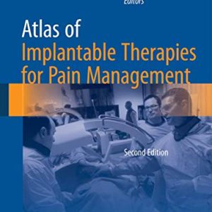 Atlas of Implantable Therapies for Pain Management ISBN-13: 9781493921096