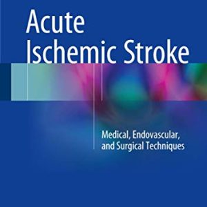 Acute Ischemic Stroke: Medical, Endovascular, and Surgical Techniques ISBN-13: 9789811009648