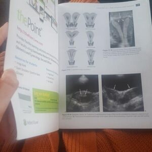 Examination Review for Ultrasound: Abdomen and Obstetrics & Gynecology 2nd Edition 9781496377296