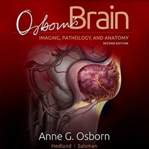 Osborn's Brain 2nd Edition 9780323477765