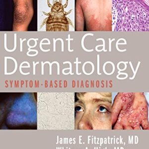 Urgent Care Dermatology: Symptom-Based Diagnosis 1st Edition 9780323485531