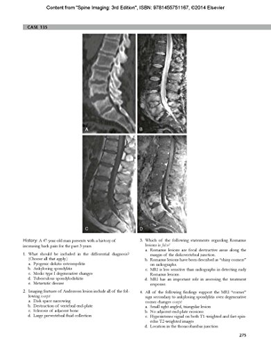 Spine Imaging: Case Review Series 3rd Edition 9781455751167 - Image 4