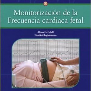 Monitorización de la frecuencia cardiaca fetal