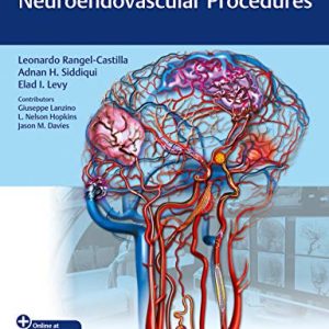 Video Atlas of Neuroendovascular Procedures ISBN-13: 9781684201181