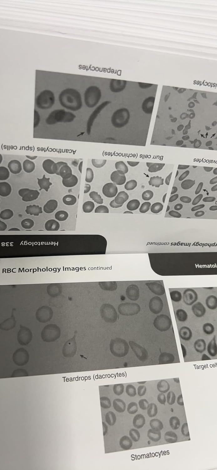 Quick Review Cards for Medical Laboratory Science Third Edition 9780803675698 - Image 2