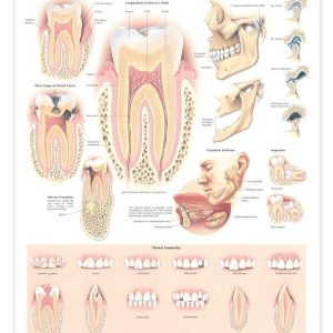 Disorders of the Teeth and Jaw Anatomical Chart