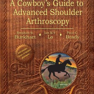 Burkharts View of the Shoulder: A Cowboys Guide to Advanced Shoulder Arthroscopy