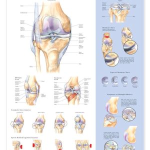Knee Injuries Anatomical Chart