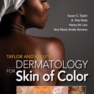 Taylor and Kelly's Dermatology for Skin of Color 2/E 2nd Edition 9780071805520