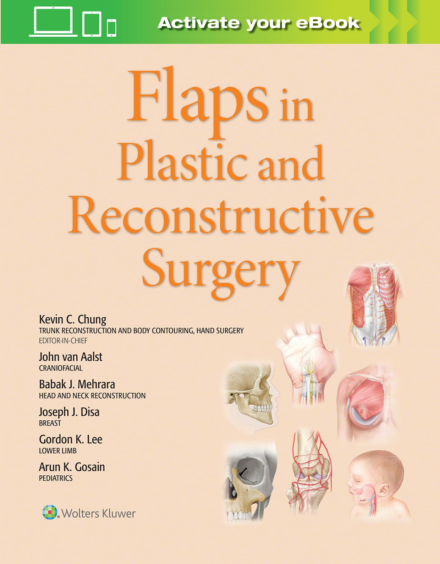 Flaps in Plastic and Reconstructive Surgery (Volume 1)