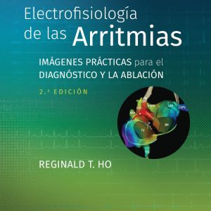Electrofisiología de las arritmias: Imágenes prácticas para el diagnóstico y la ablación (Spanish Edition)