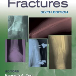 Handbook of Fractures 6th Edition 9781496384850