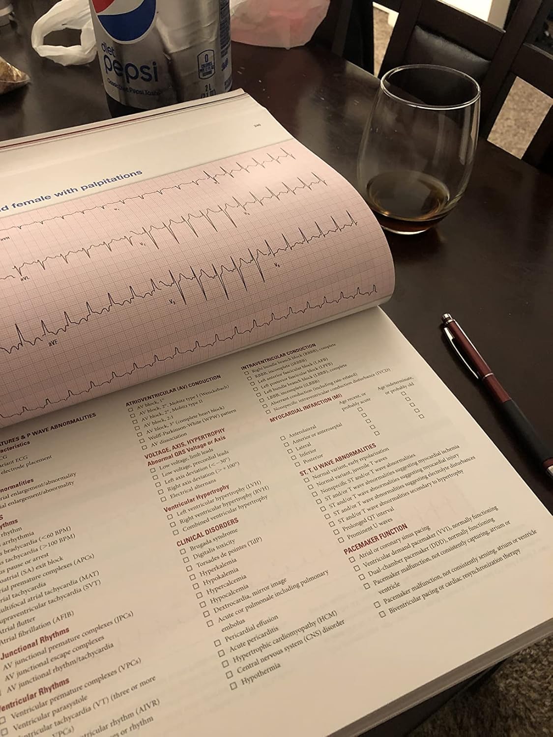 The Complete Guide to ECGs: A Comprehensive Study Guide to Improve ECG Interpretation Skills: A Comprehensive Study Guide to Improve ECG Interpretation Skills 5th Edition 9781284199055 - Image 2