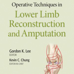 Operative Techniques in Lower Limb Reconstruction and Amputation