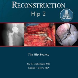 Advanced Reconstruction: Hip 2: Print + Ebook with Multimedia (AAOS – American Academy of Orthopaedic Surgeons)