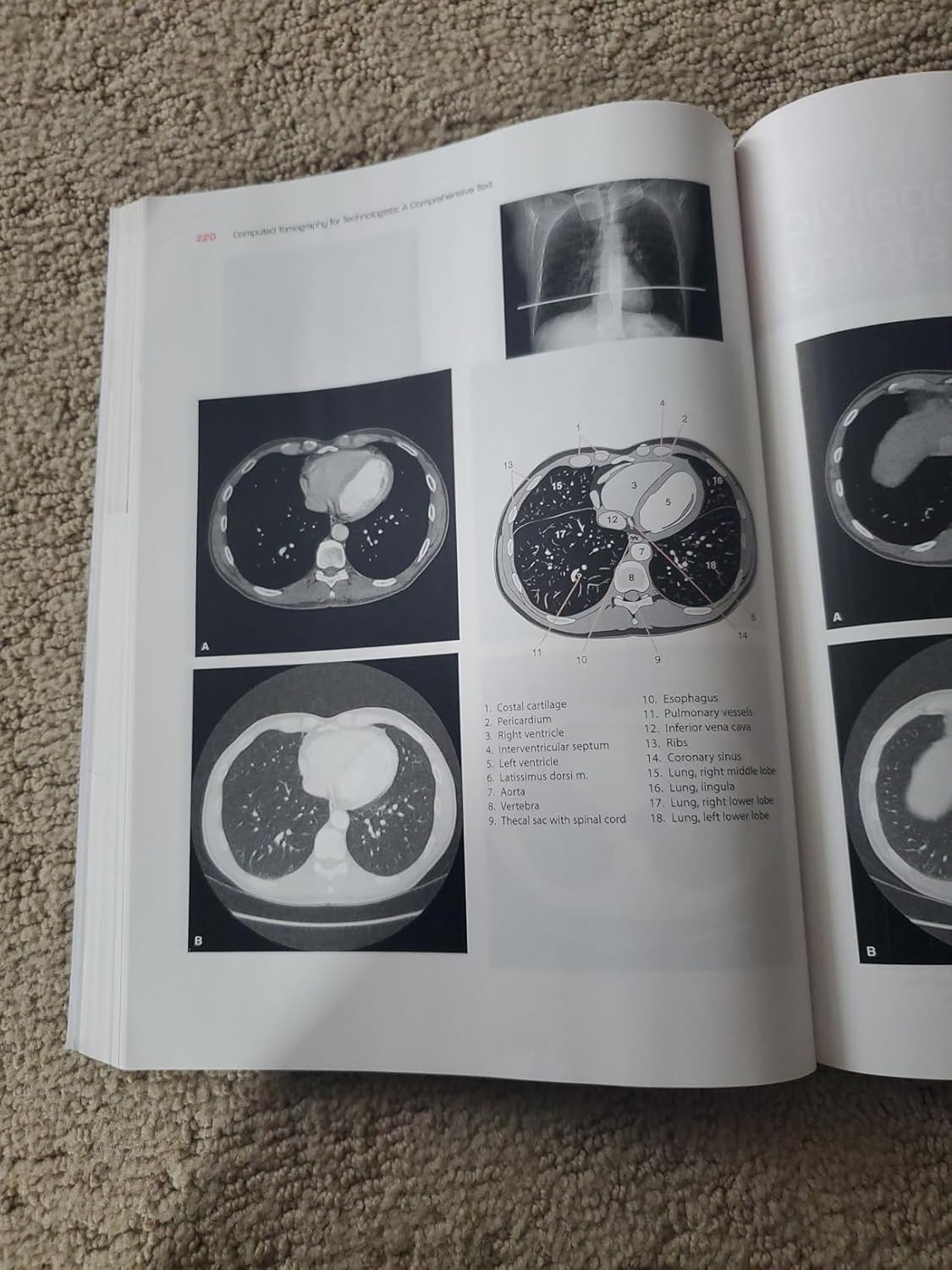 Computed Tomography for Technologists: A Comprehensive Text 2nd Edition 9781496375858 - Image 5