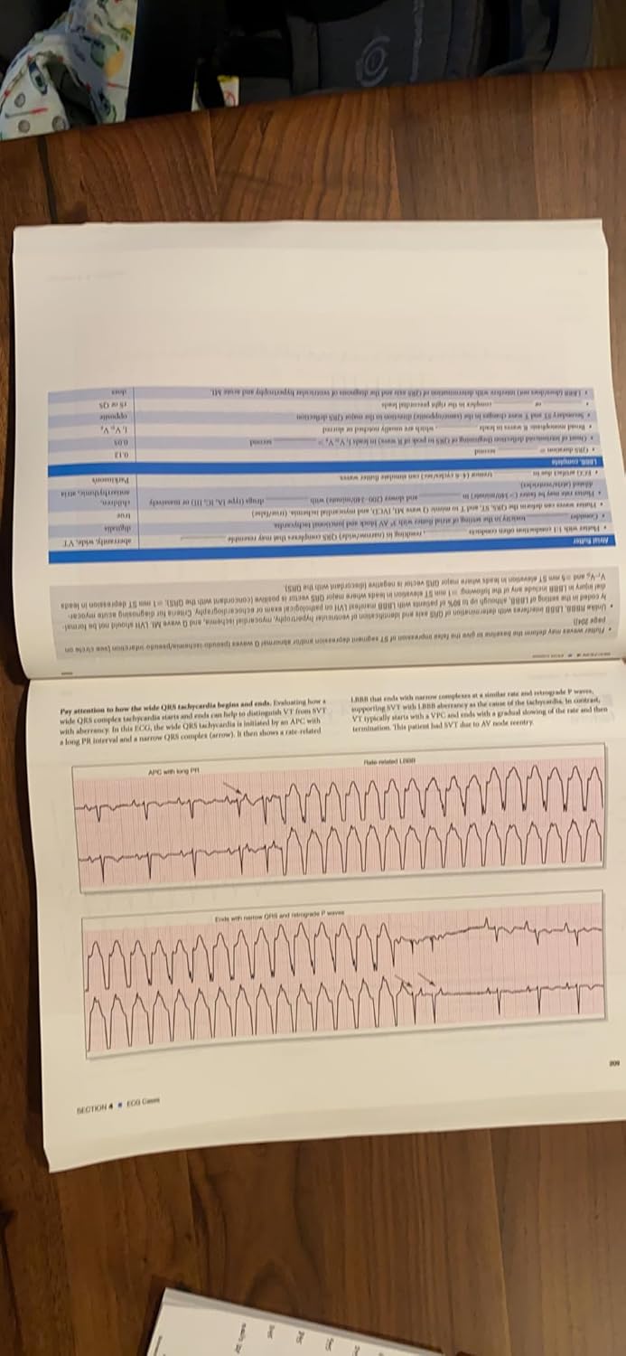 The Complete Guide to ECGs: A Comprehensive Study Guide to Improve ECG Interpretation Skills: A Comprehensive Study Guide to Improve ECG Interpretation Skills 5th Edition 9781284199055 - Image 6