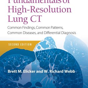 Fundamentals of High-Resolution Lung CT: Common Findings, Common Patterns, Common Diseases and Differential Diagnosis