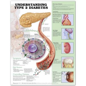 Understanding Type 2 Diabetes Anatomical Chart