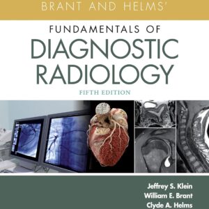 Brant and Helms' Fundamentals of Diagnostic Radiology 5th Edition 9781496367389
