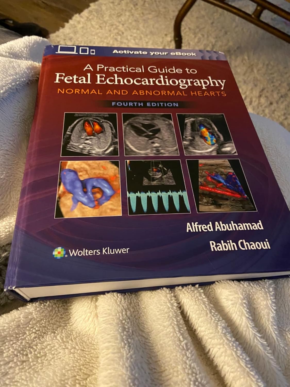 A Practical Guide to Fetal Echocardiography: Normal and Abnormal Hearts Fourth Edition 9781975126810 - Image 8