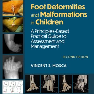 Foot Deformities and Malformations in Children: A Principles-Based, Practical Guide to Assessment and Management: Print + eBook with Multimedia