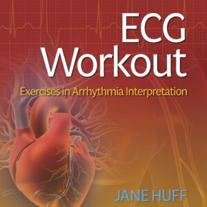 ECG Workout: Exercises in Arrhythmia Interpretation Eighth