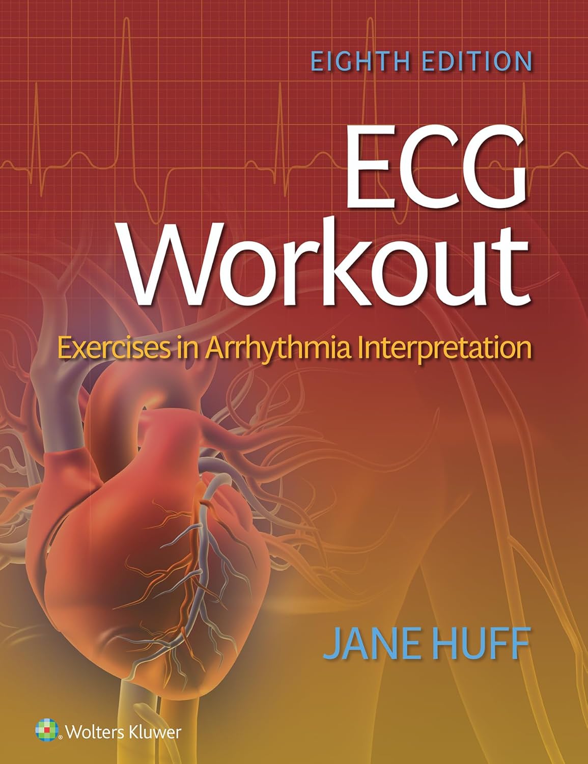 ECG Workout: Exercises in Arrhythmia Interpretation Eighth