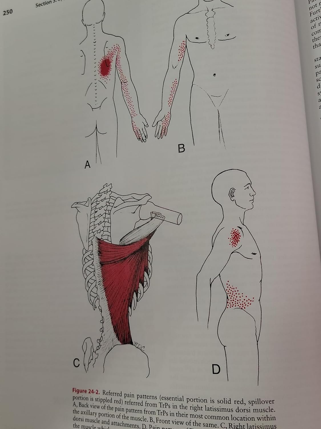 LWW - Travell, Simons & Simons' Myofascial Pain and Dysfunction: The Trigger Point Manual 3rd Edition 9780781755603 - Image 5