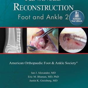 Advanced Reconstruction: Foot and Ankle 2: Print + Ebook (AAOS – American Academy of Orthopaedic Surgeons)