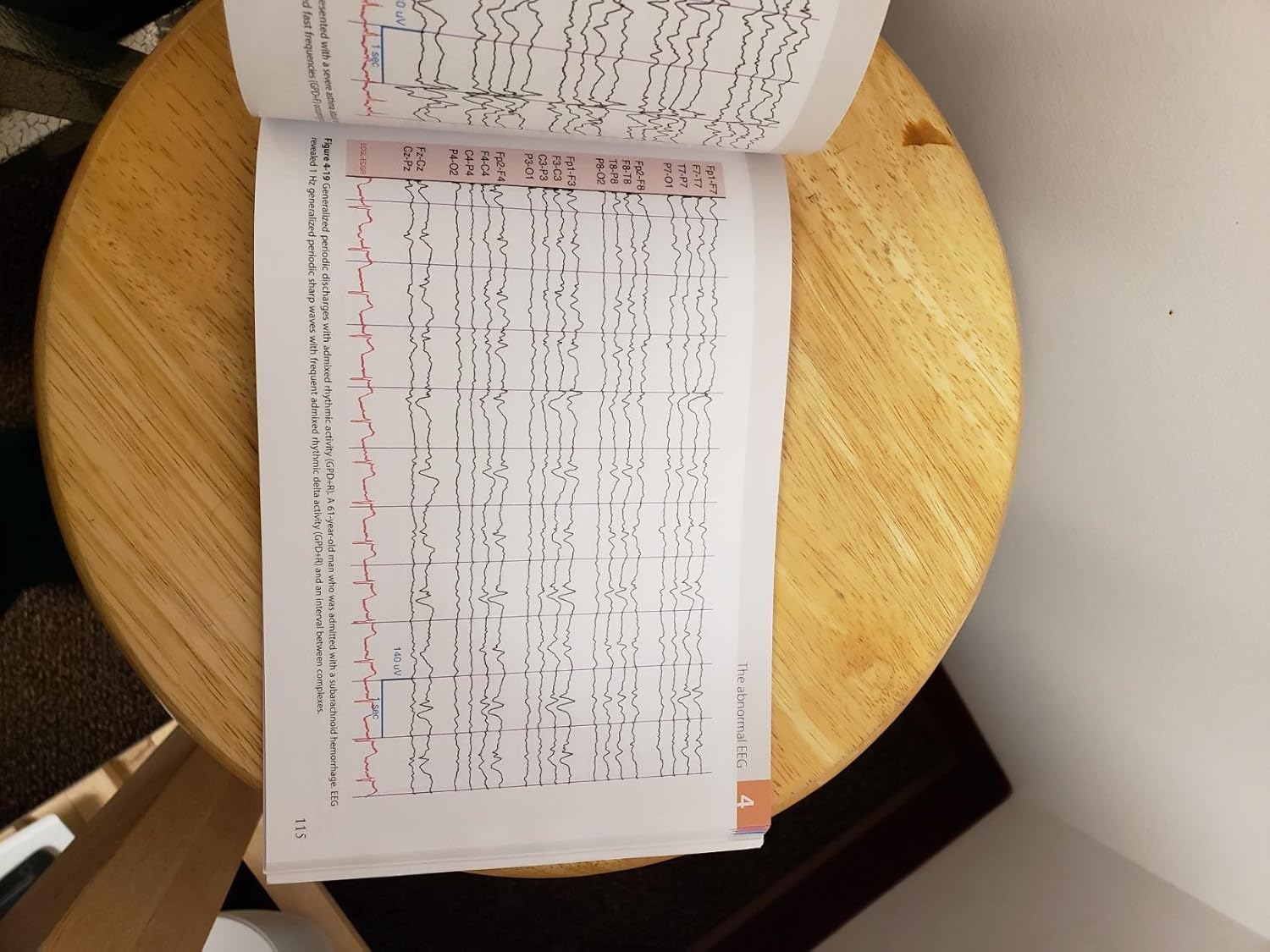 Rowan's Primer of EEG 2nd Edition 9780323353878 - Image 4