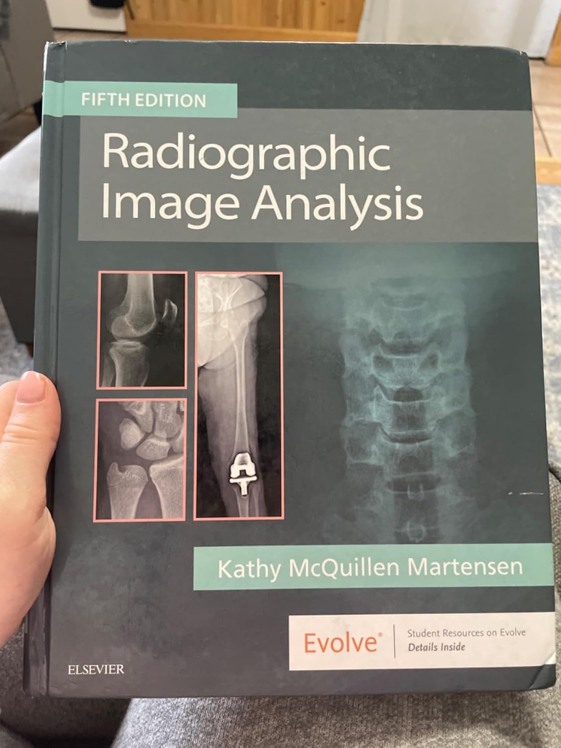 Radiographic Image Analysis 5th Edition 9780323522816 - Image 7