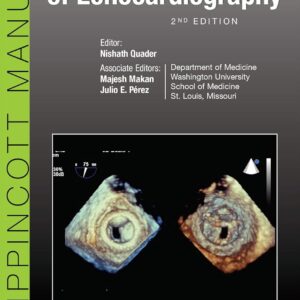 The Washington Manual of Echocardiography Second Edition 9781496321282