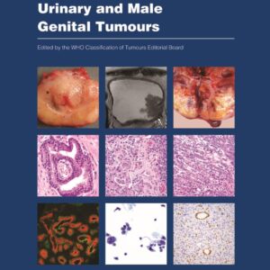 Urinary and Male Genital Tumours (WHO Classification of Tumours
