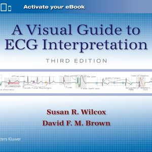 A Visual Guide to ECG Interpretation: Print + eBook with Multimedia