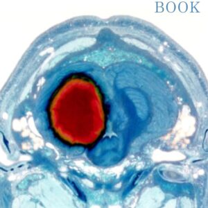 The NeuroICU Book