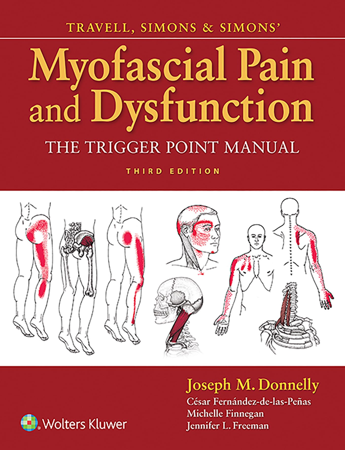 LWW - Travell, Simons & Simons Myofascial Pain and Dysfunction: The Trigger Point Manual