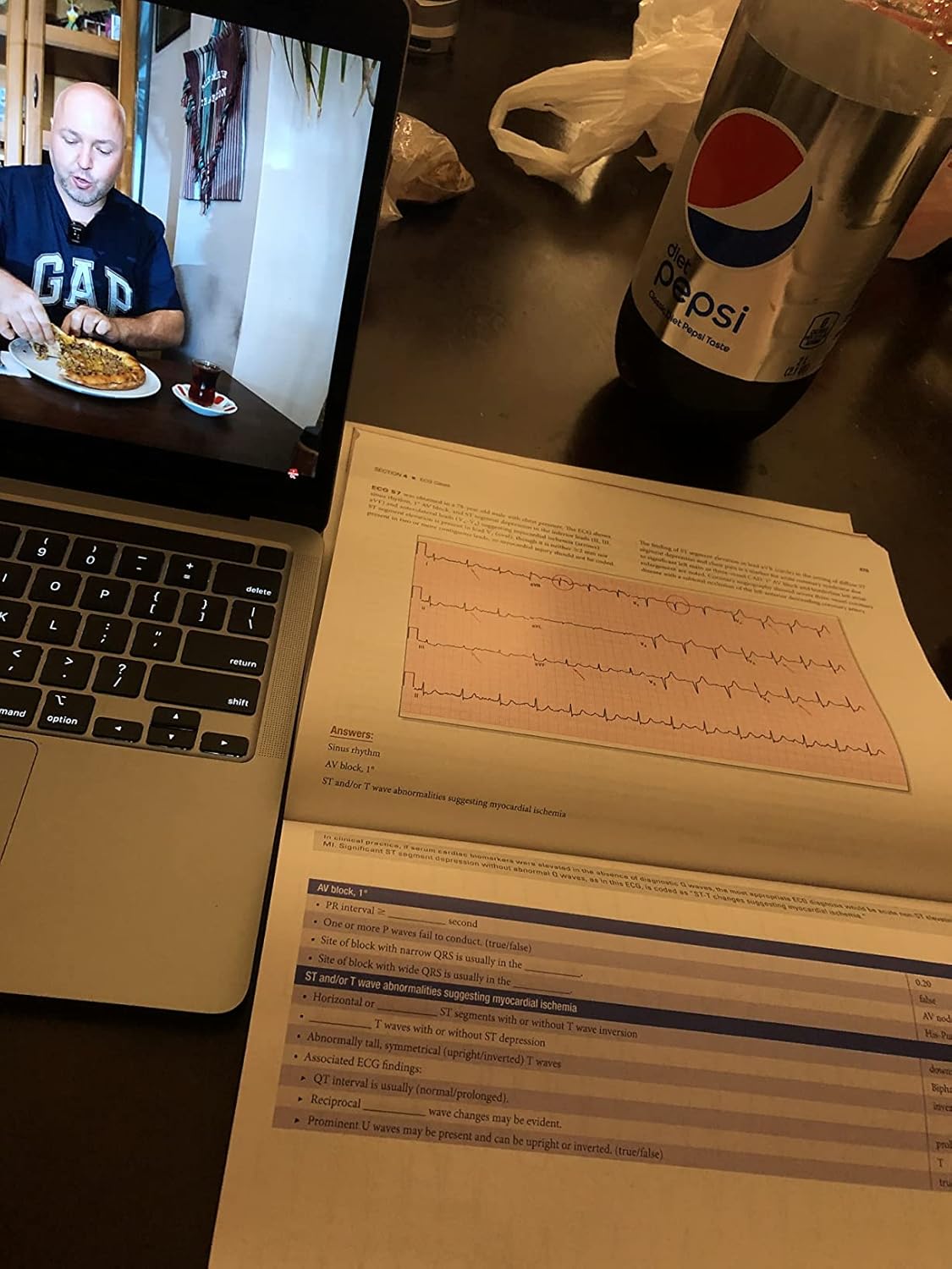 The Complete Guide to ECGs: A Comprehensive Study Guide to Improve ECG Interpretation Skills: A Comprehensive Study Guide to Improve ECG Interpretation Skills 5th Edition 9781284199055 - Image 4