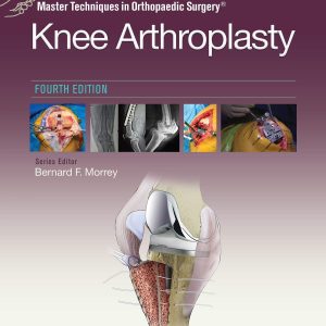 Master Techniques in Orthopedic Surgery: Knee Arthroplasty (Master Techniques in Orthopaedic Surgery)