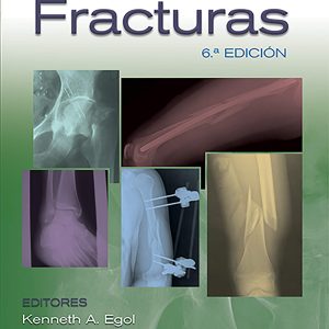 Manual de fracturas (Spanish Edition)
