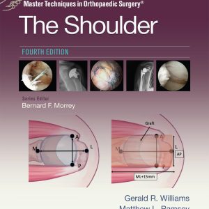 Master Techniques in Orthopaedic Surgery: The Shoulder: Print + eBook with Multimedia