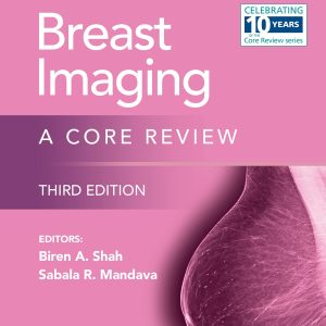 Breast Imaging: A Core Review: Print + eBook with Multimedia (The Core Review)