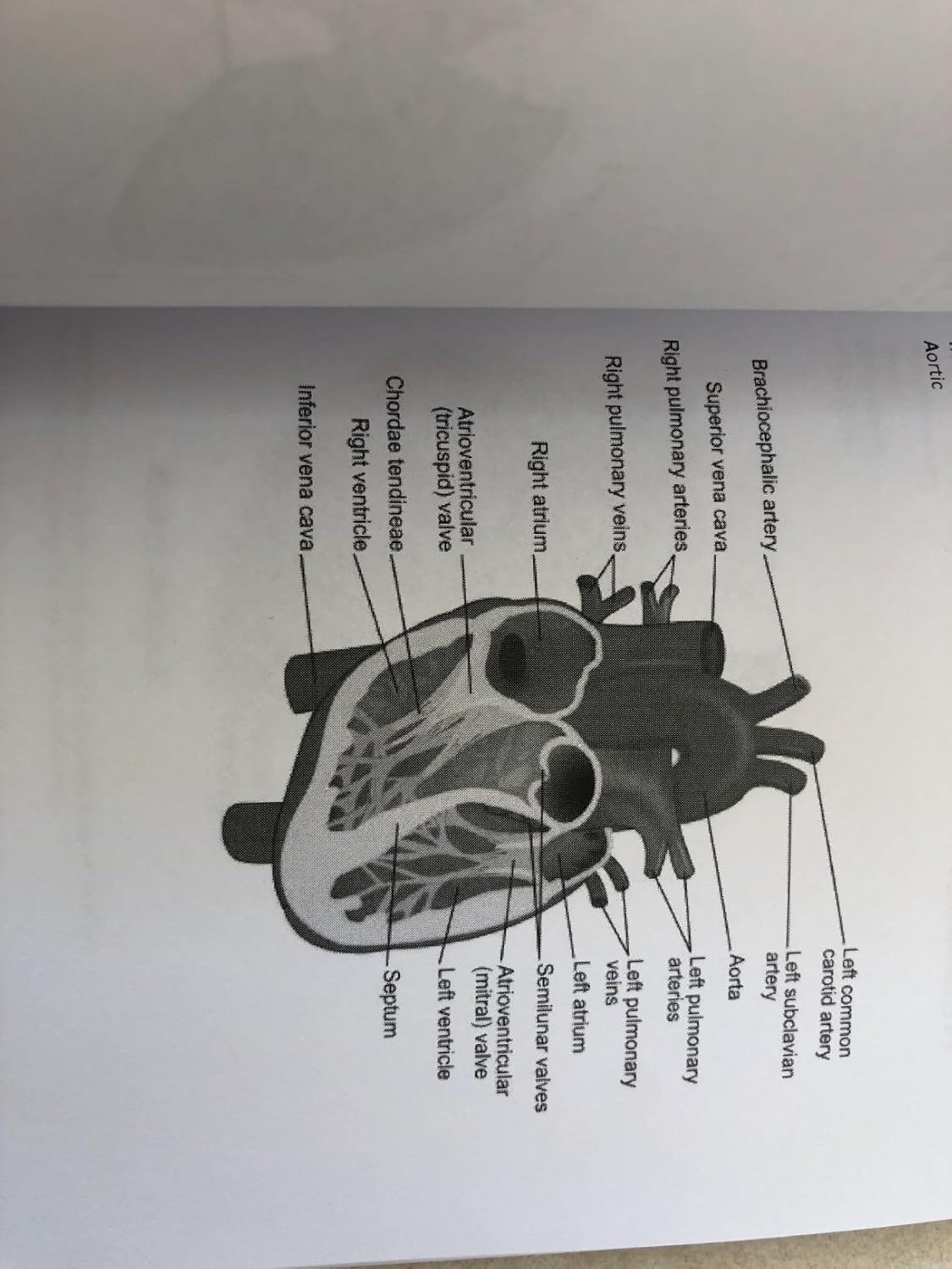 Nursing Mnemonics: 108 Memory Tricks to Demolish Nursing School 1st Edition 9781511448642 - Image 5