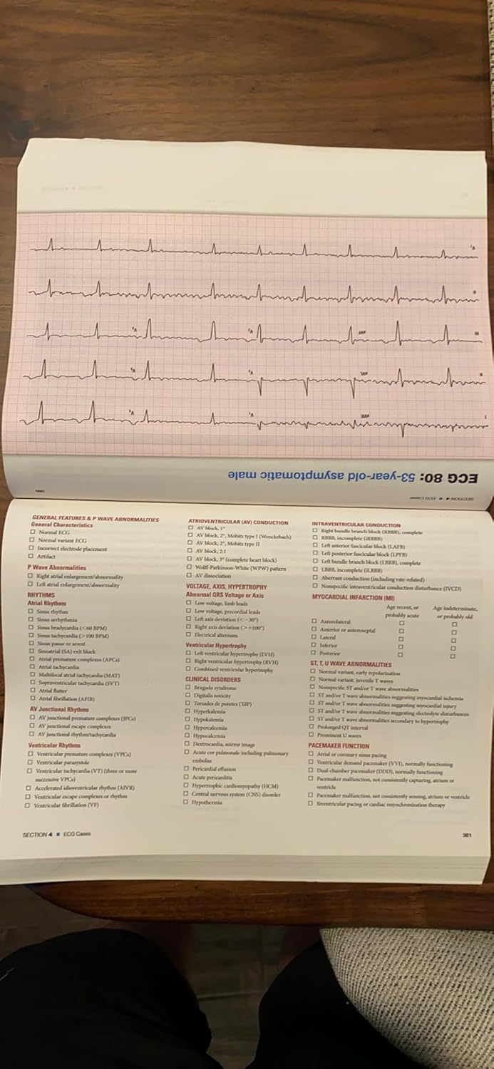 The Complete Guide to ECGs: A Comprehensive Study Guide to Improve ECG Interpretation Skills: A Comprehensive Study Guide to Improve ECG Interpretation Skills 5th Edition 9781284199055 - Image 3
