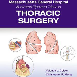 Massachusetts General Hospital Illustrated Tips and Tricks in Thoracic Surgery: Print + eBook with Multimedia